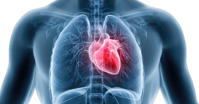 Peripheral Vascular Disease